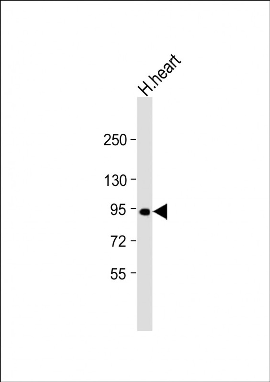 Western Blot at 1:1000 dilution + human heart lysate Lysates/proteins at 20 ug per lane.