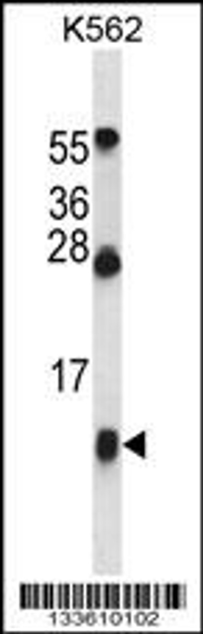 Western blot analysis in K562 cell line lysates (35ug/lane) .