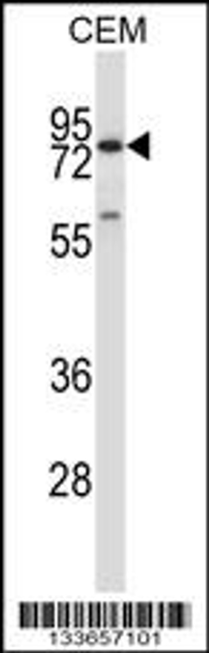 Western blot analysis in CEM cell line lysates (35ug/lane) .