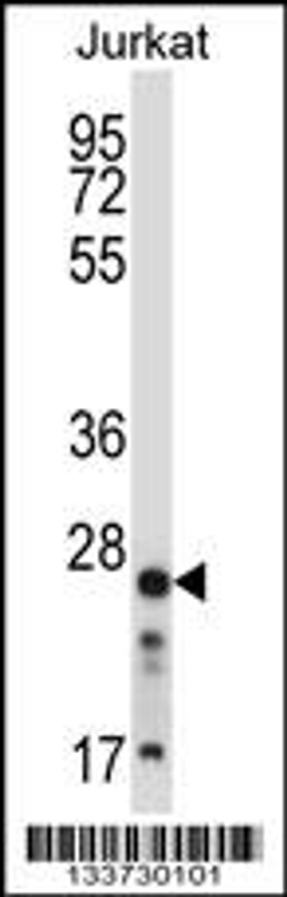 Western blot analysis in Jurkat cell line lysates (35ug/lane) .