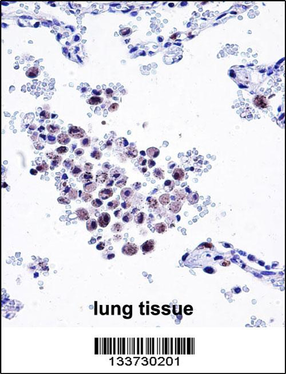 ARHGDIB Antibody immunohistochemistry analysis in formalin fixed and paraffin embedded human lung tissue followed by peroxidase conjugation of the secondary antibody and DAB staining.