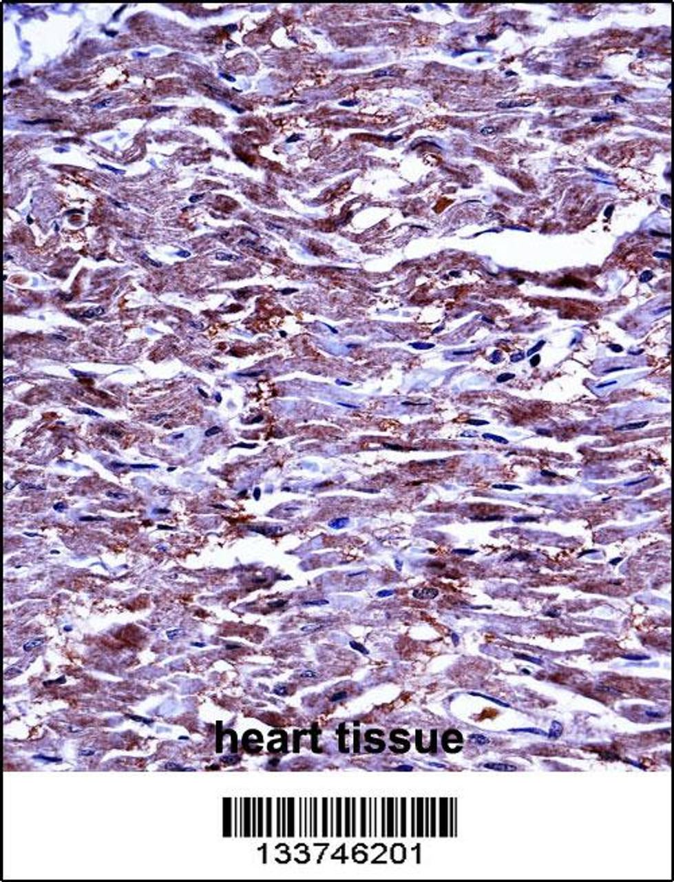 MMP15 Antibody immunohistochemistry analysis in formalin fixed and paraffin embedded human heart tissue followed by peroxidase conjugation of the secondary antibody and DAB staining.