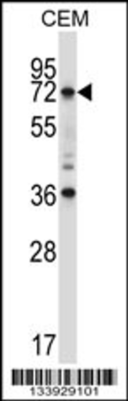 Western blot analysis in CEM cell line lysates (35ug/lane) .