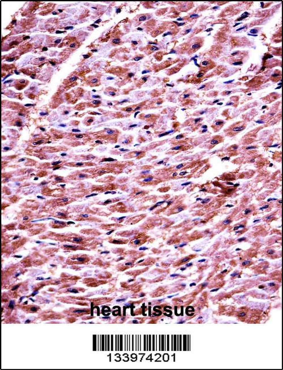 DHRS7C Antibody immunohistochemistry analysis in formalin fixed and paraffin embedded human heart tissue followed by peroxidase conjugation of the secondary antibody and DAB staining.