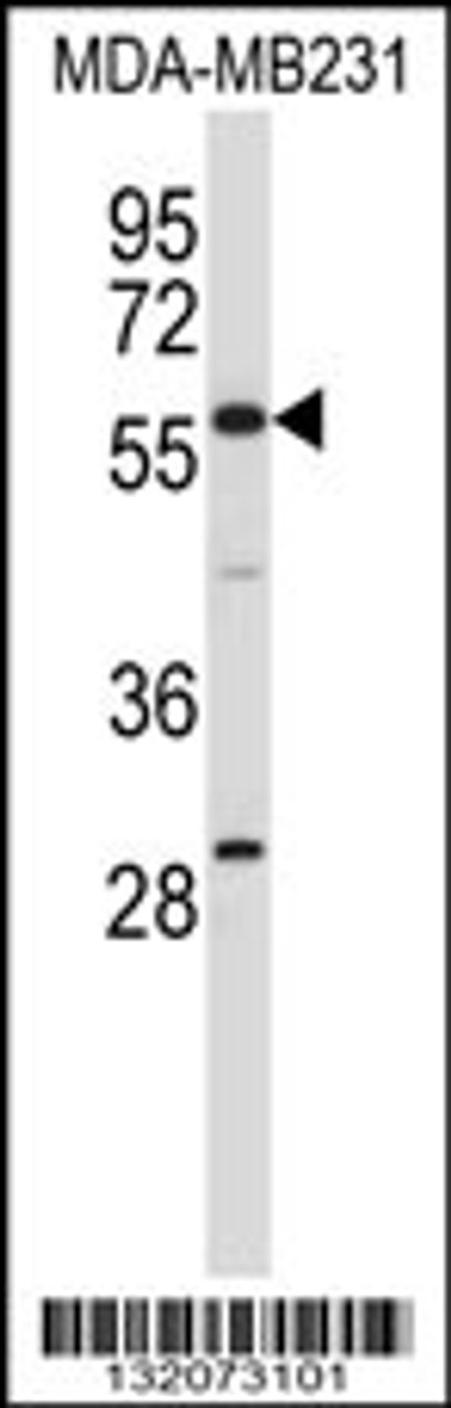 Western blot analysis in MDA-MB231 cell line lysates (35ug/lane) .