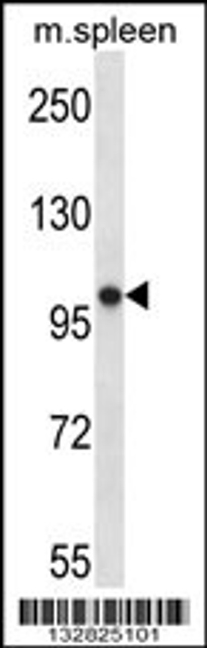 Western blot analysis in mouse spleen tissue lysates (35ug/lane) .