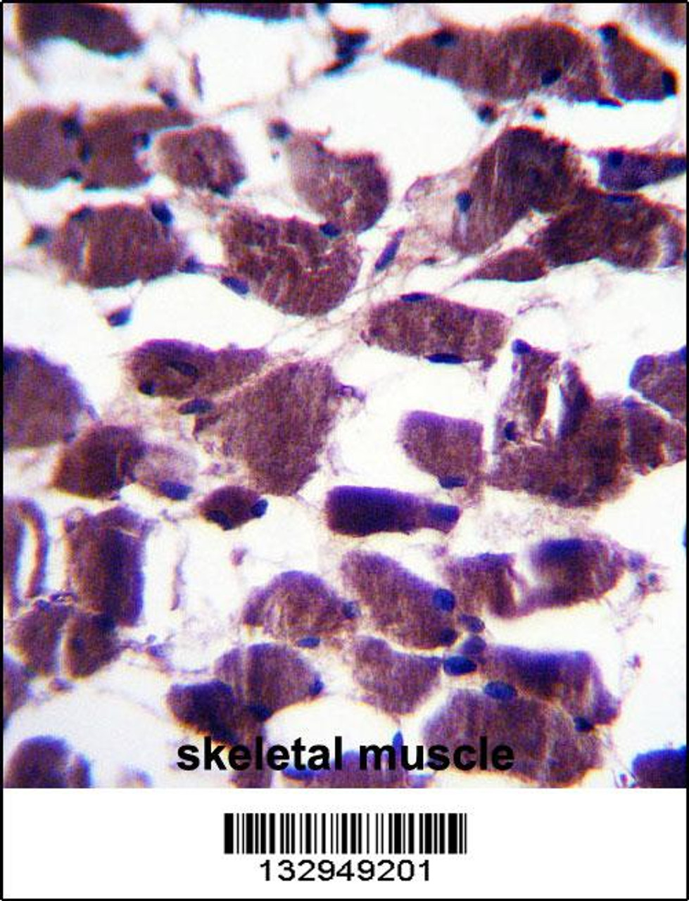 LRIG2 Antibody immunohistochemistry analysis in formalin fixed and paraffin embedded human skeletal muscle followed by peroxidase conjugation of the secondary antibody and DAB staining.