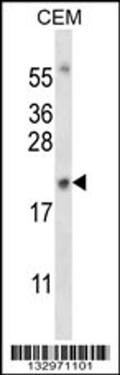 Western blot analysis in CEM cell line lysates (35ug/lane) .