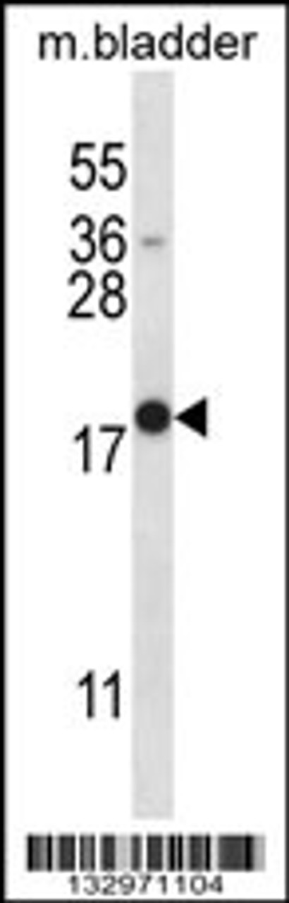 Western blot analysis in mouse bladder tissue lysates (35ug/lane) .