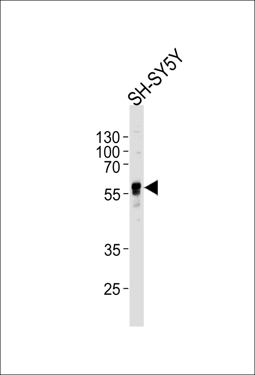 Western blot analysis of lysate from SH-SY5Y cell line, using ABHD3 Antibody at 1:1000 at each lane.