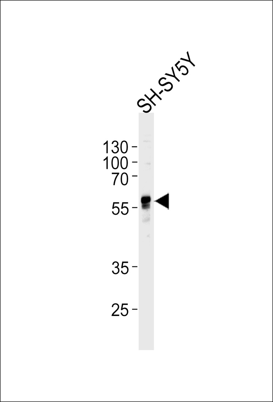 Western blot analysis of lysate from SH-SY5Y cell line, using ABHD3 Antibody at 1:1000 at each lane.