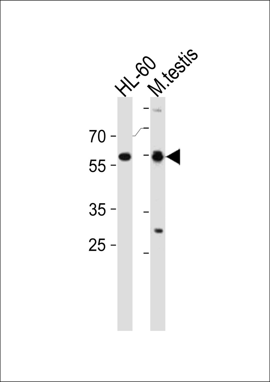 Western blot analysis in HL-60 cell line and mouse testis tissue lysates (35ug/lane) .