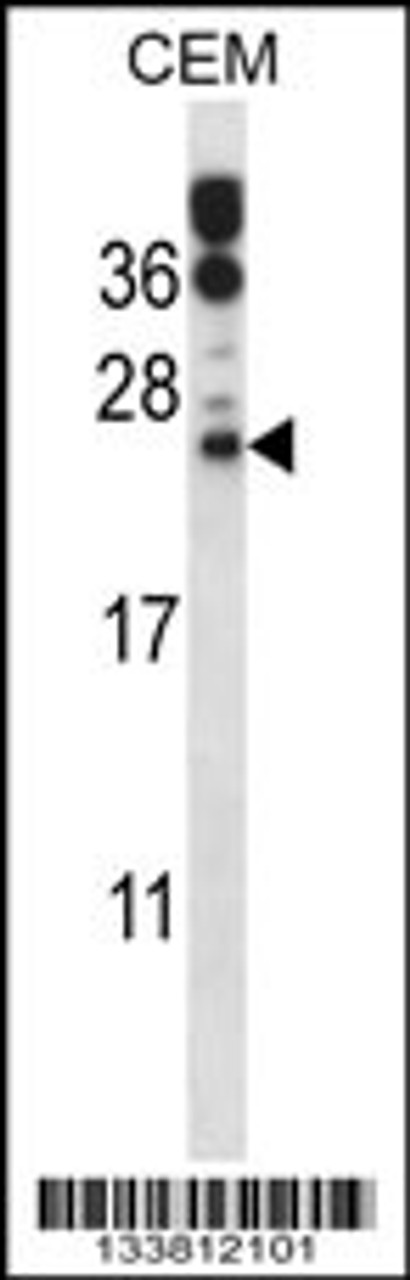 Western blot analysis in CEM cell line lysates (35ug/lane) .