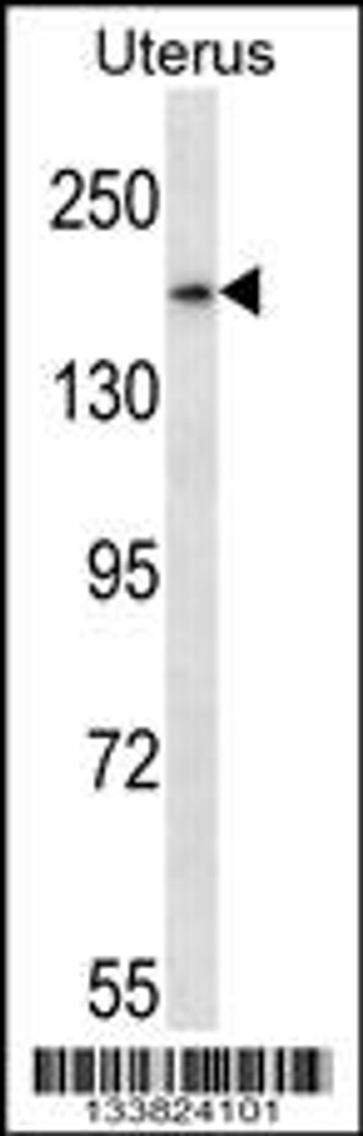 Western blot analysis in human normal Uterus tissue lysates (35ug/lane) .