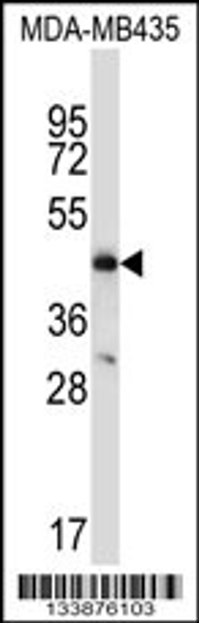 Western blot analysis in MDA-MB435 cell line lysates (35ug/lane) .