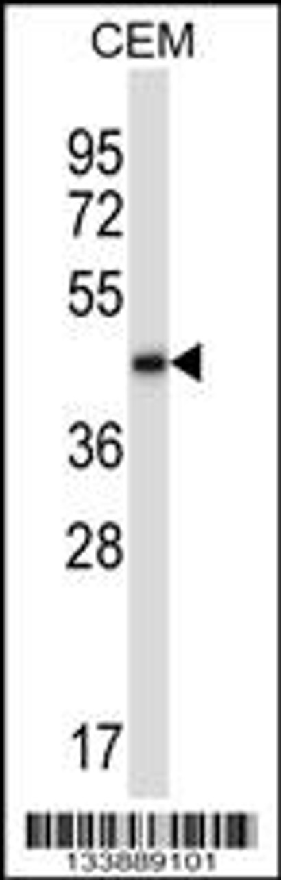 Western blot analysis in CEM cell line lysates (35ug/lane) .