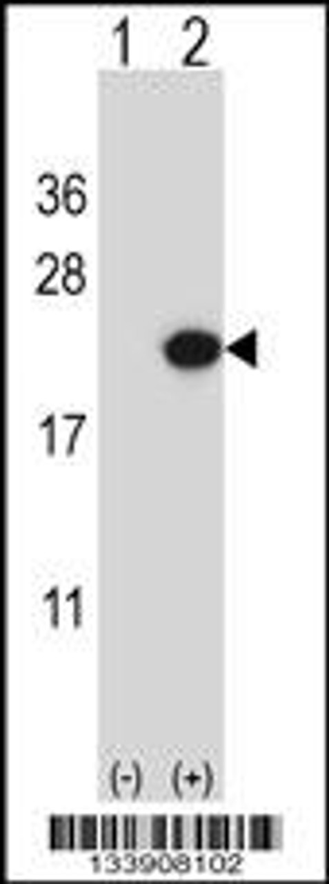 Western blot analysis of EDN2 using rabbit polyclonal EDN2 Antibody using 293 cell lysates (2 ug/lane) either nontransfected (Lane 1) or transiently transfected (Lane 2) with the EDN2 gene.