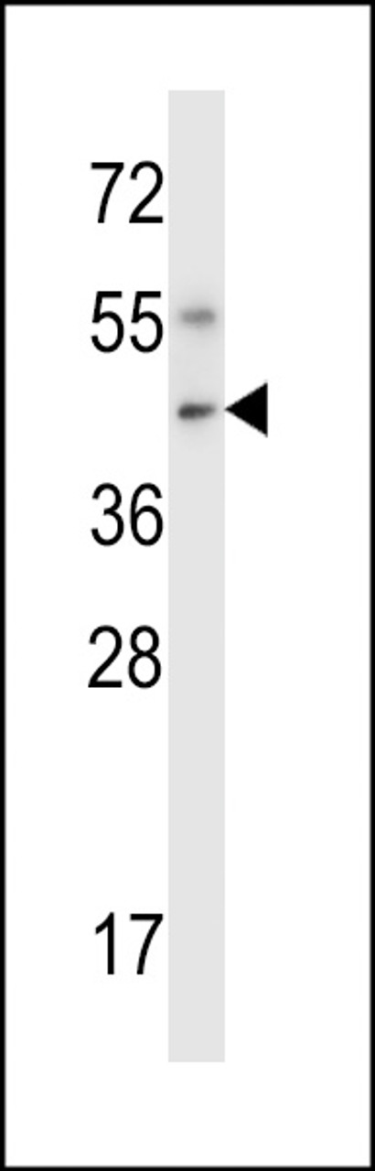 Western blot analysis in mouse liver tissue lysates (35ug/lane) .