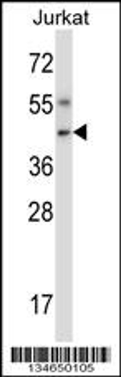 Western blot analysis in Jurkat cell line lysates (35ug/lane) .