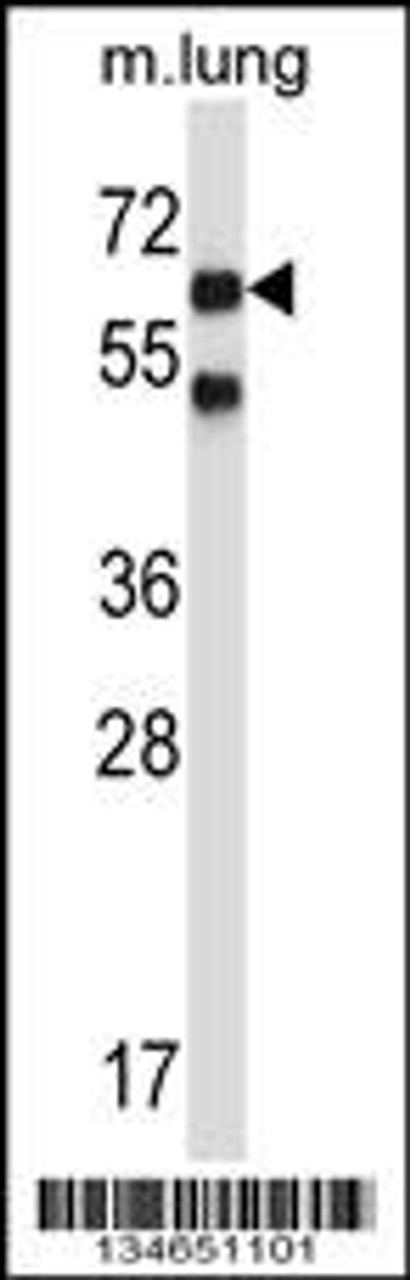 Western blot analysis in mouse lung tissue lysates (35ug/lane) .This demonstratedetected the Nlk protein (arrow) .