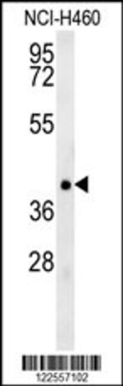 Western blot analysis in NCI-H460 cell line lysates (35ug/lane) .