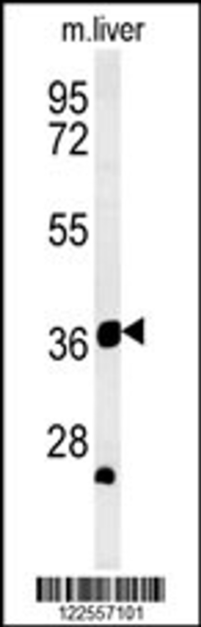 Western blot analysis in mouse liver tissue lysates (35ug/lane) .