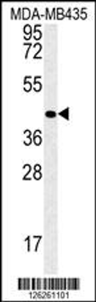 Western blot analysis in MDA-MB435 cell line lysates (35ug/lane) .