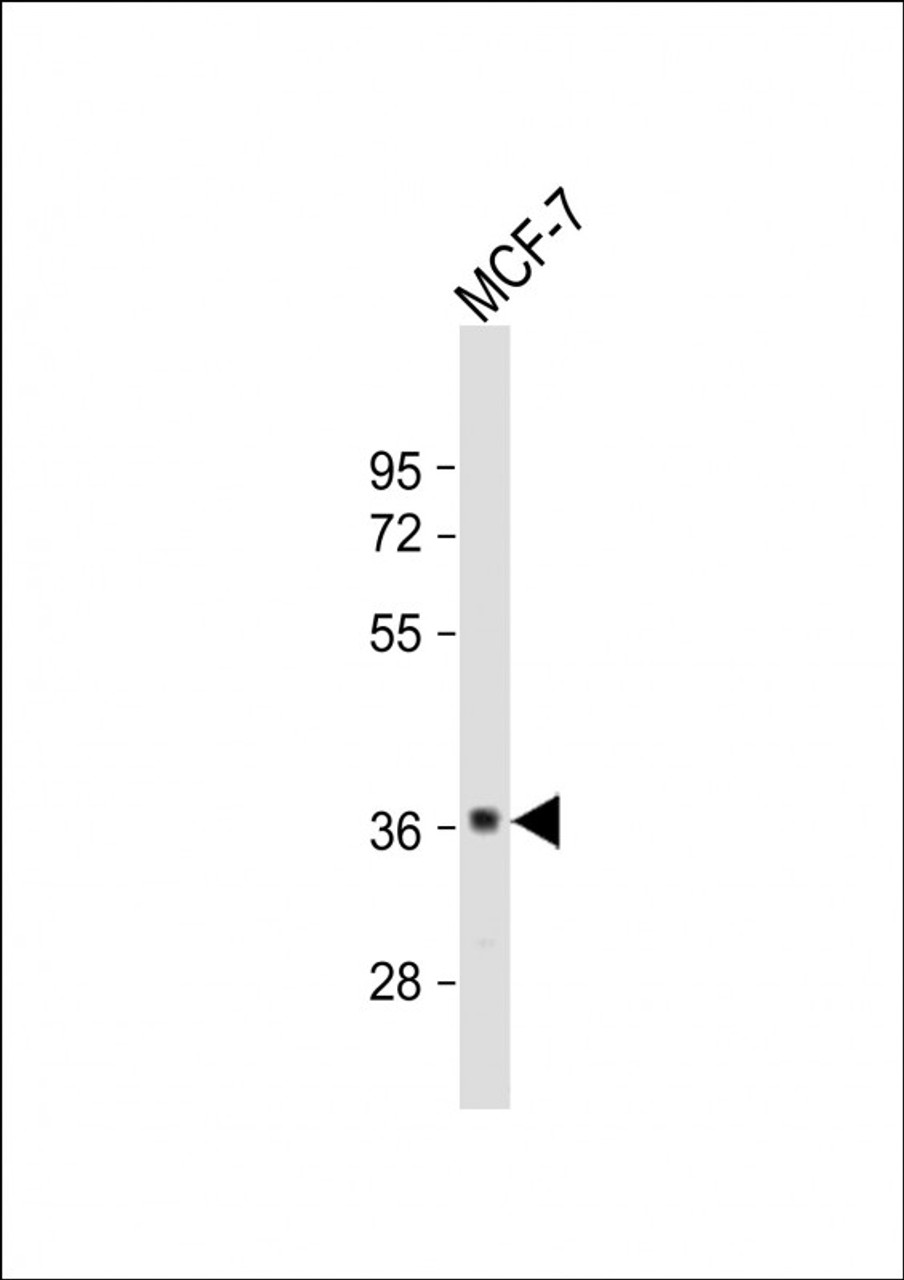 Western Blot at 1:1000 dilution + MCF-7 whole cell lysate Lysates/proteins at 20 ug per lane.