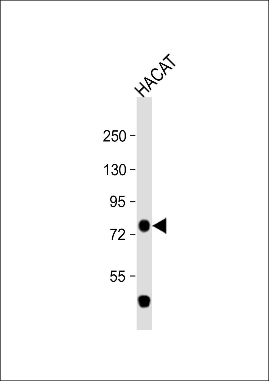 Western Blot at 1:1000 dilution + HACAT whole cell lysate Lysates/proteins at 20 ug per lane.