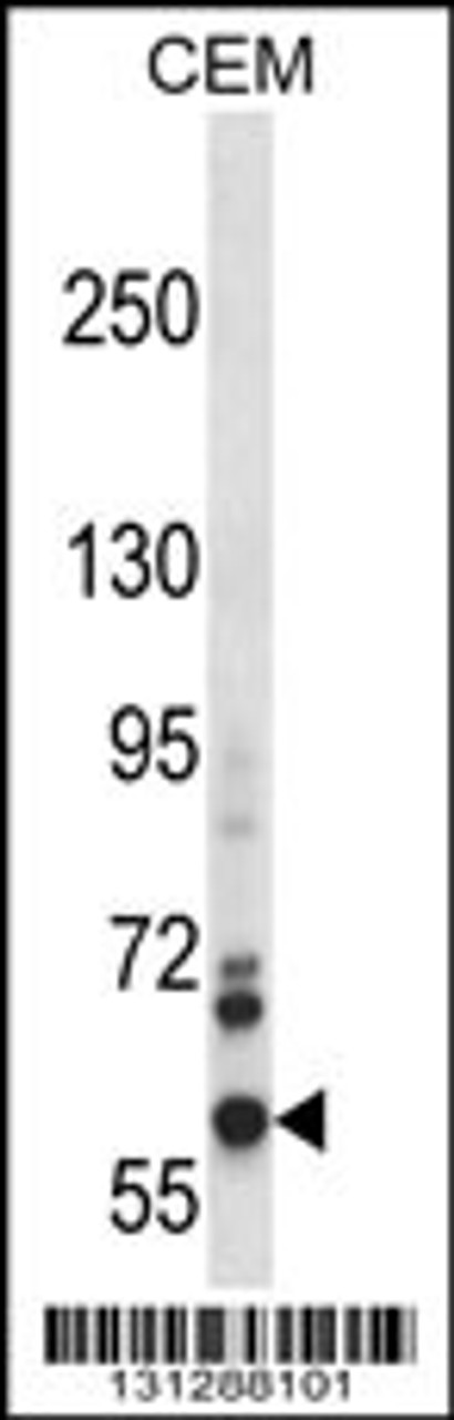 Western blot analysis in CEM cell line lysates (35ug/lane) .