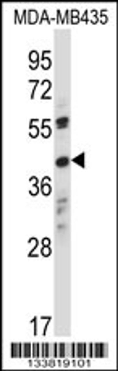 Western blot analysis in MDA-MB435 cell line lysates (35ug/lane) .