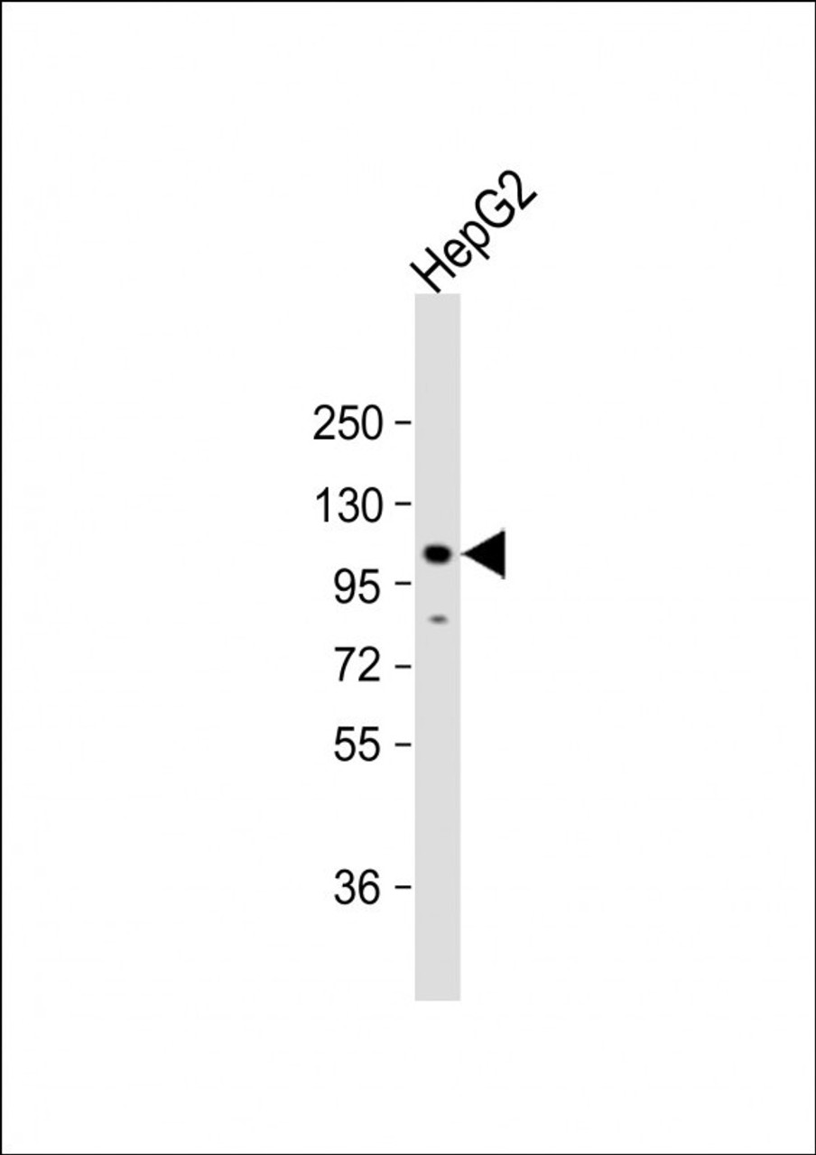 Western Blot at 1:2000 dilution + HepG2 whole cell lysate Lysates/proteins at 20 ug per lane.