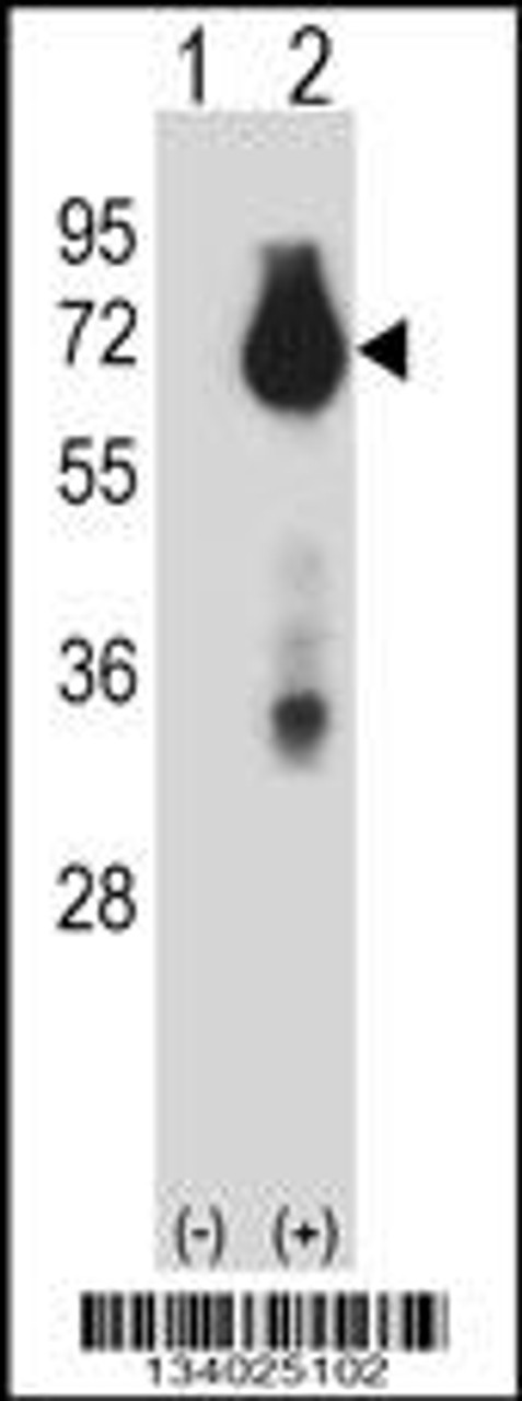 Western blot analysis of BIRC3 using rabbit polyclonal BIRC3 Antibody using 293 cell lysates (2 ug/lane) either nontransfected (Lane 1) or transiently transfected (Lane 2) with the BIRC3 gene.