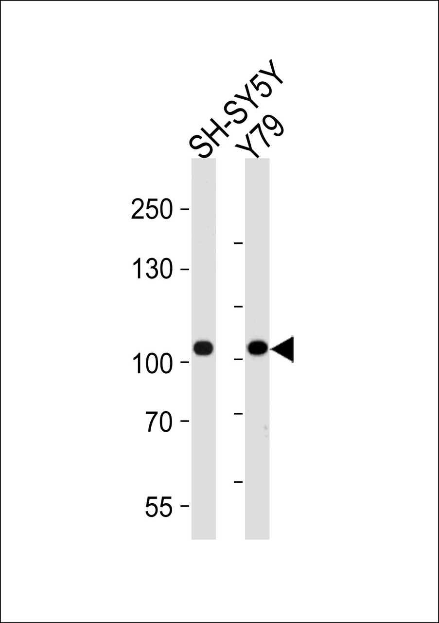 Western blot analysis of lysates from SH-SY5Y, Y79 cell line (from left to right) , using CDH8 Antibody at 1:1000 at each lane.