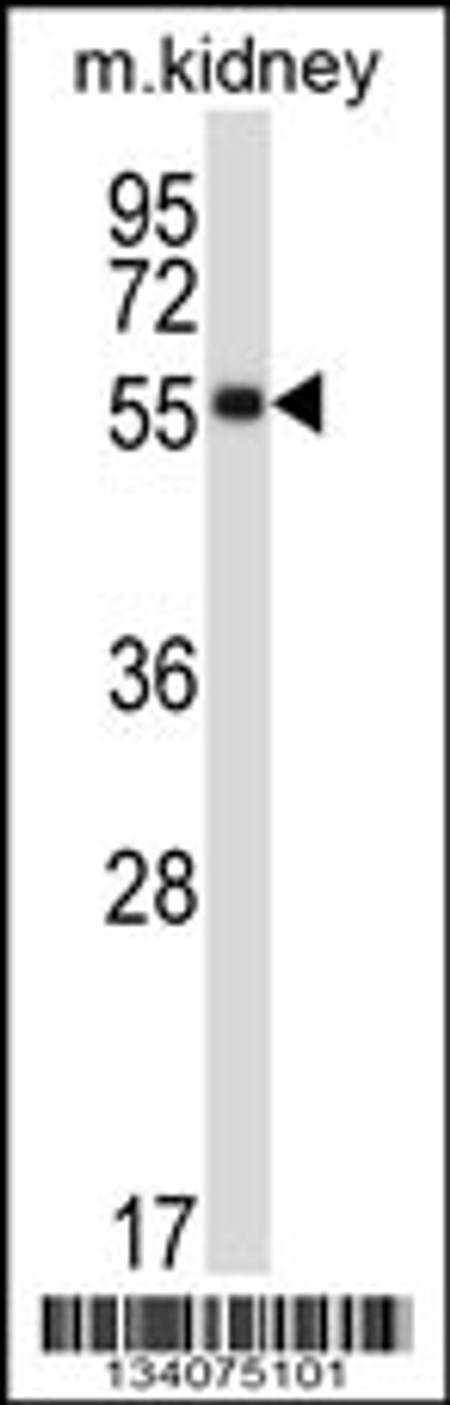 Western blot analysis in mouse kidney tissue lysates (35ug/lane) .