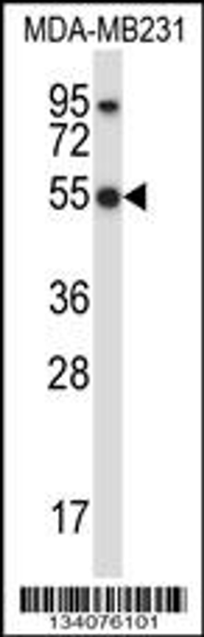 Western blot analysis in MDA-MB231 cell line lysates (35ug/lane) .