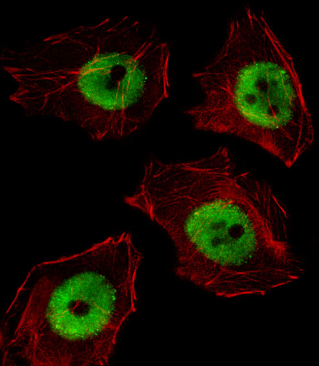 Fluorescent image of A549 cell stained with UBP1 Antibody .A549 cells were fixed with 4% PFA (20 min) , permeabilized with Triton X-100 (0.1%, 10 min) , then incubated with UBP1 primary antibody (1:25) . For secondary antibody, Alexa Fluor 488 conjugated donkey anti-rabbit antibody (green) was used (1:400) .Cytoplasmic actin was counterstained with Alexa Fluor 555 (red) conjugated Phalloidin (7units/ml) .UBP1 immunoreactivity is localized to Nucleus significantly.
