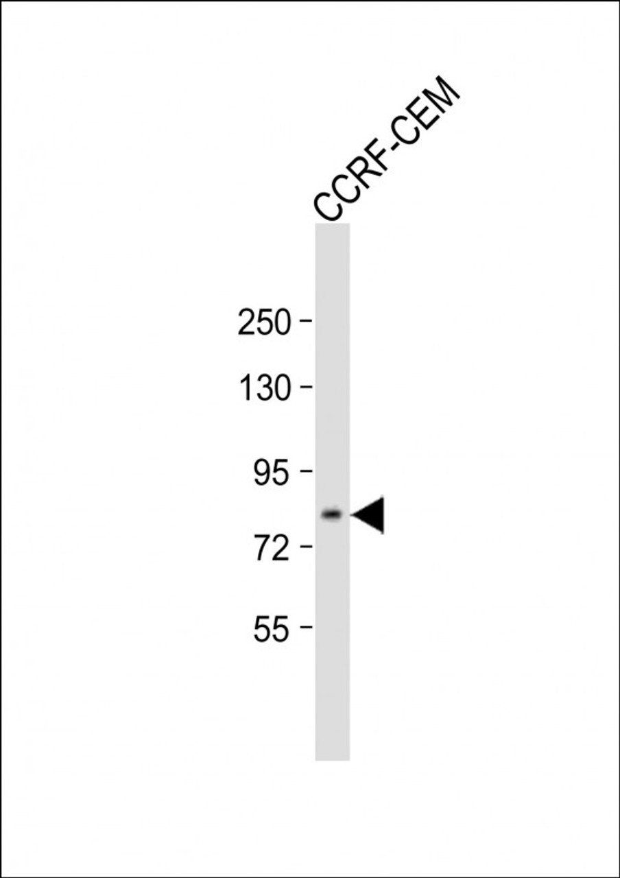 Western Blot at 1:500 dilution + CCRF-CEM whole cell lysate Lysates/proteins at 20 ug per lane.