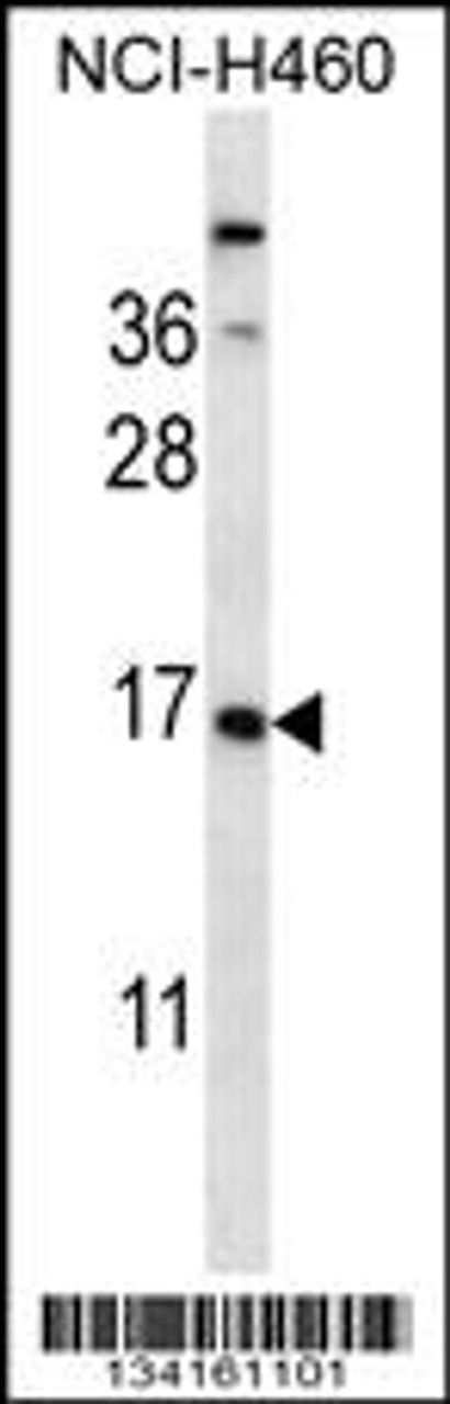 Western blot analysis in NCI-H460 cell line lysates (35ug/lane) .