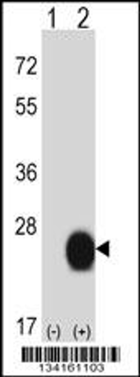 Western blot analysis of CSRP2 using rabbit polyclonal CSRP2 Antibody using 293 cell lysates (2 ug/lane) either nontransfected (Lane 1) or transiently transfected (Lane 2) with the CSRP2 gene.