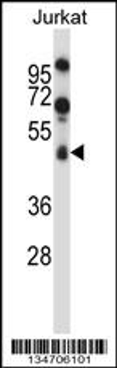 Western blot analysis in Jurkat cell line lysates (35ug/lane) .