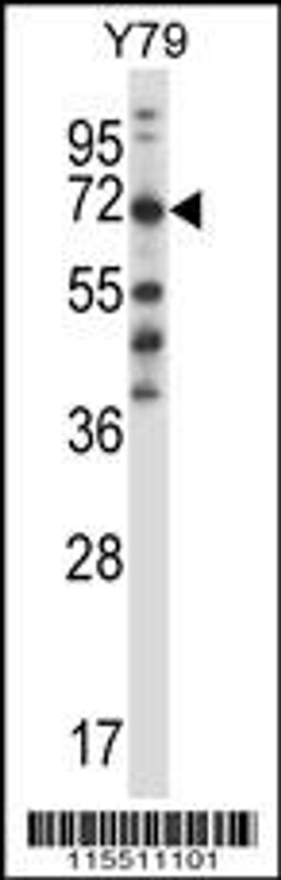 Western blot analysis in Y79 cell line lysates (35ug/lane) .