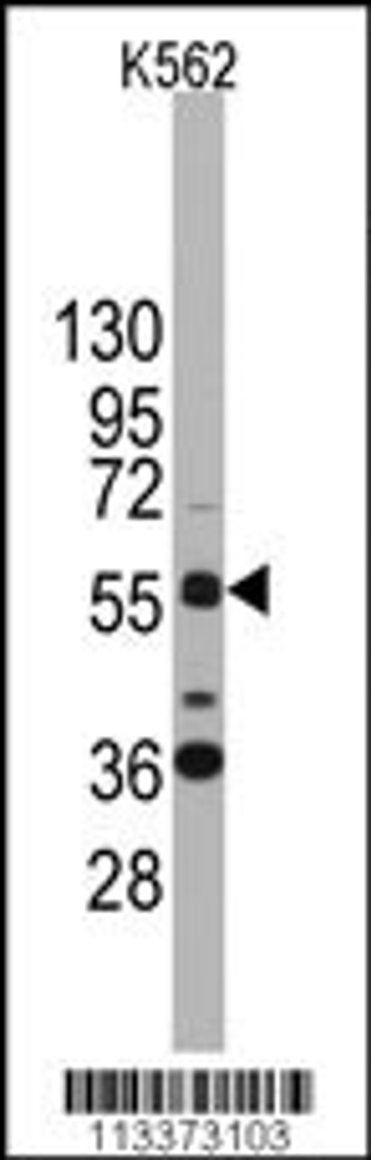 Western blot analysis of anti-SOX9 Antibody in K562 cell line lysates (35ug/lane)