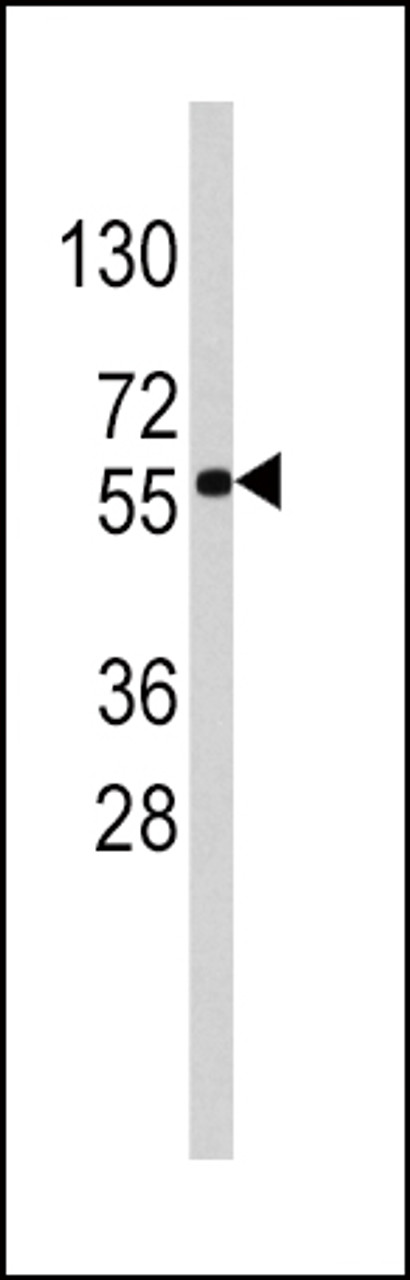 Western blot analysis of anti-SOX9 Antibody in HepG2 cell line lysates (35ug/lane)