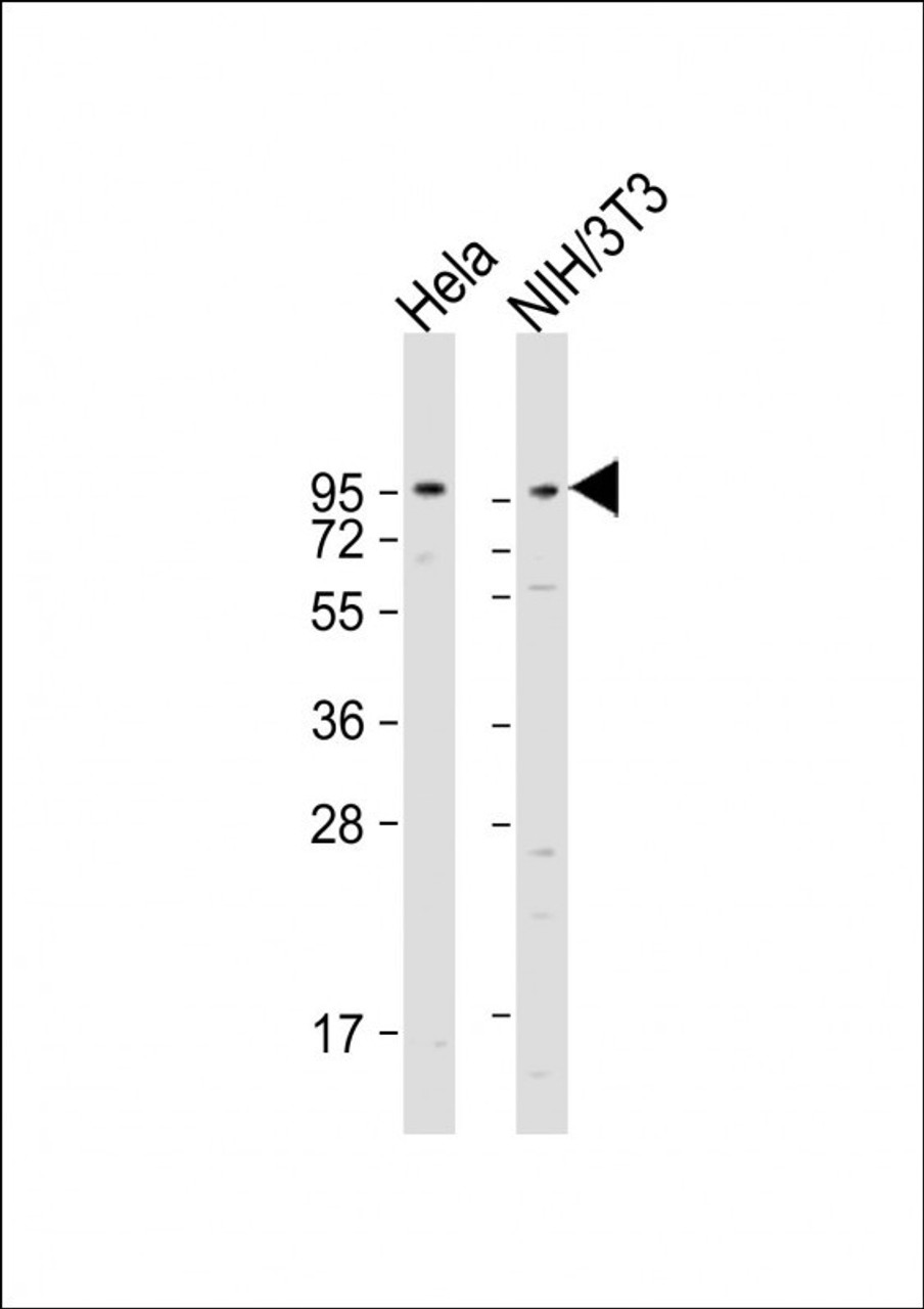 Western Blot at 1:1000-1:2000 dilution Lane 1: Hela whole cell lysate Lane 2: NIH/3T3 whole cell lysate Lysates/proteins at 20 ug per lane.