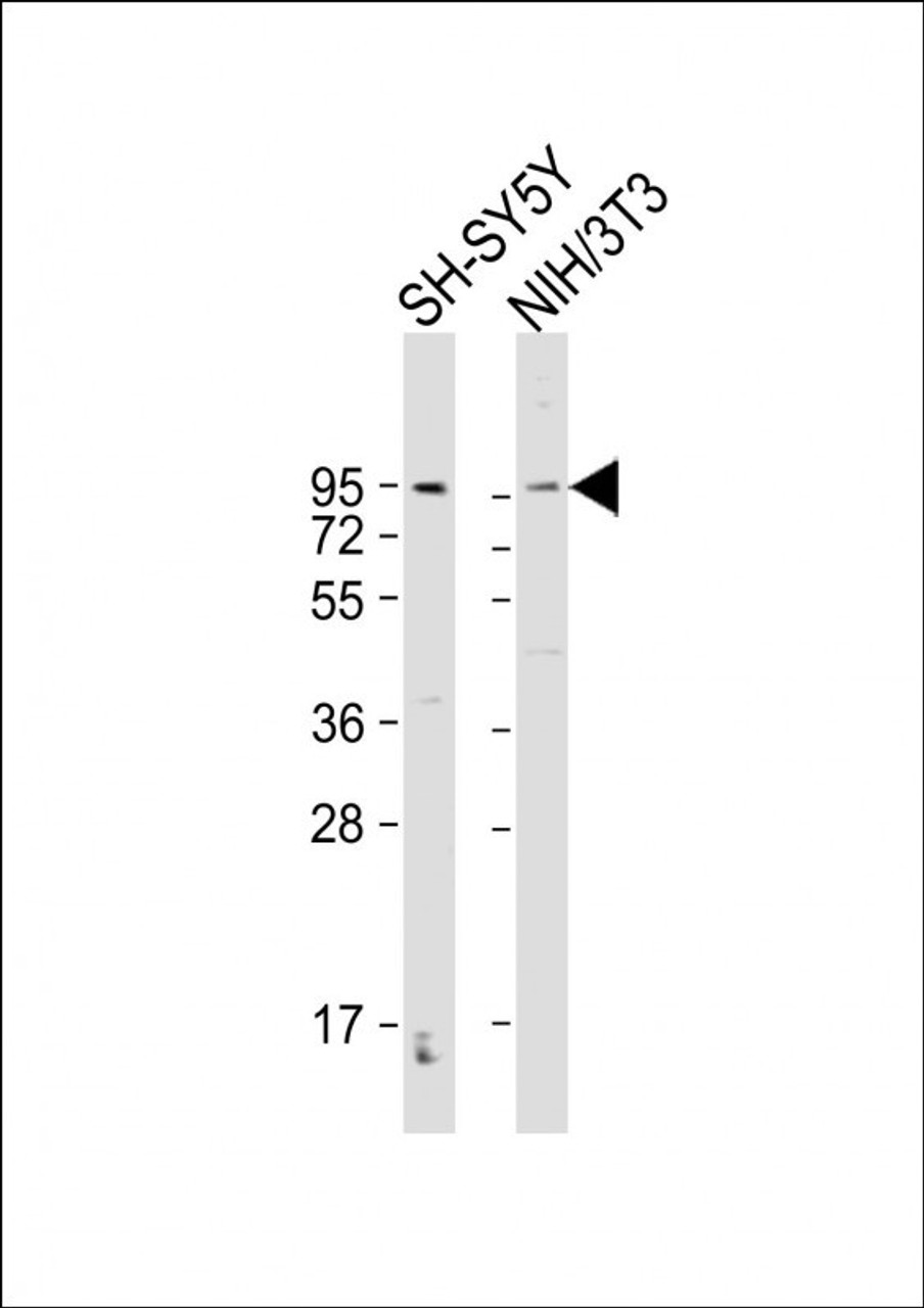 Western Blot at 1:2000 dilution Lane 1: SH-SY5Y whole cell lysate Lane 2: NIH/3T3 whole cell lysate Lysates/proteins at 20 ug per lane.