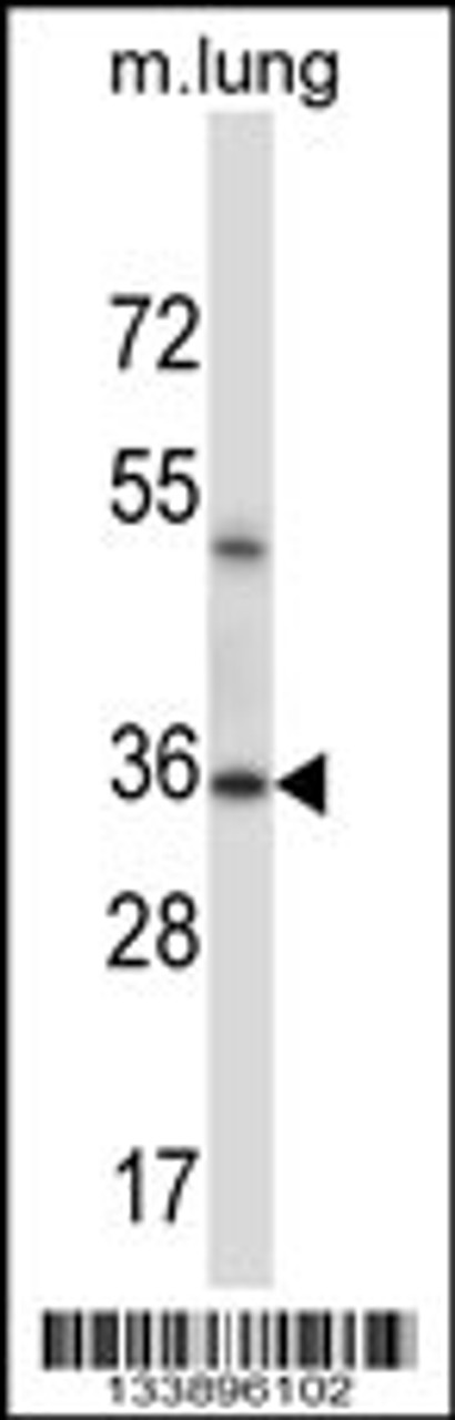 Western blot analysis in mouse lung tissue lysates (35ug/lane) .