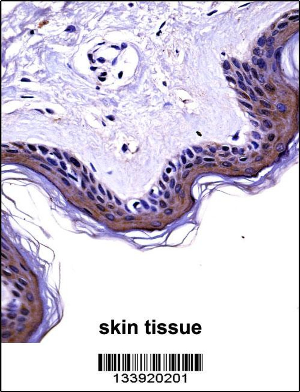 NCK2 Antibody immunohistochemistry analysis in formalin fixed and paraffin embedded human skin tissue followed by peroxidase conjugation of the secondary antibody and DAB staining.