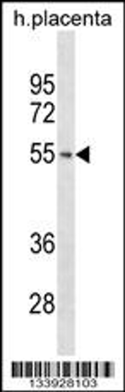 Western blot analysis in human placenta tissue lysates (35ug/lane) .