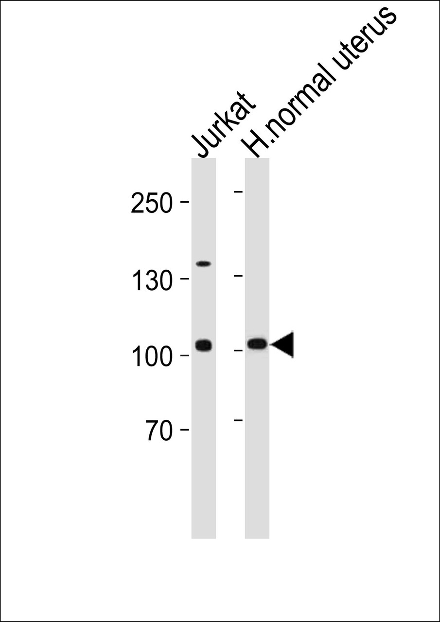 Western blot analysis in Jurkat cell line and human normal uterus tissue lysates (35ug/lane) .This demonstrdetected the TERT protein (arrow) .
